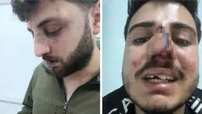 Van'da İşkence İddiası Yargı ve Meclis Gündeminde: 13 Polis Teşhis Edildi