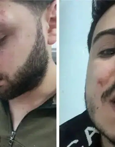 Van'da İşkence İddiası Yargı ve Meclis Gündeminde: 13 Polis Teşhis Edildi