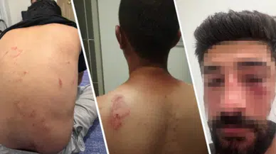 Mersin’de sekiz kişilik aile, Kürtçe konuştukları için saldırıya uğradı