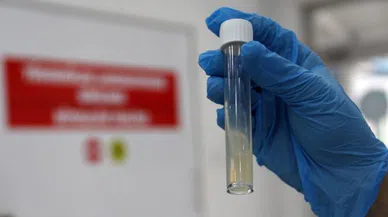 Dünyanın en ölümcül bulaşıcı hastalığı geçen yıl 1 milyon can aldı