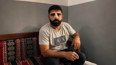 Bayburt’ta Amedspor forması giyen iki kişiye saldırı: Bir kişinin burnunda 5 kırık oluştu