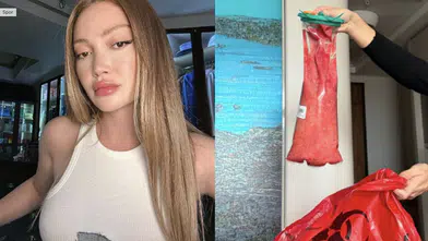 Beşinci kalça ameliyatı: Danla Bilic, vücudundan çıkan dolguyu paylaştı