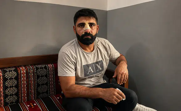 Bayburt’ta Amedspor forması giyen iki kişiye saldırı: Bir kişinin burnunda 5 kırık oluştu