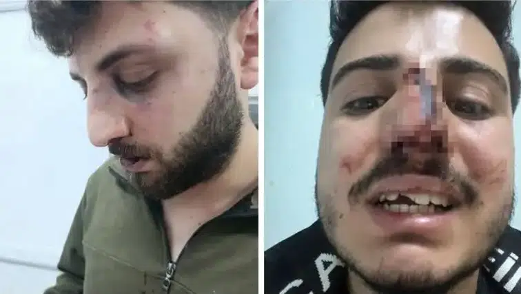 Van'da İşkence İddiası Yargı ve Meclis Gündeminde: 13 Polis Teşhis Edildi