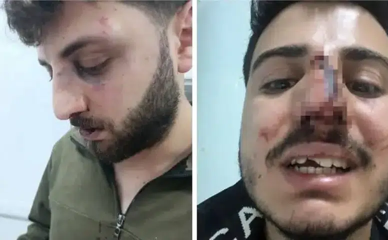 Van'da İşkence İddiası Yargı ve Meclis Gündeminde: 13 Polis Teşhis Edildi