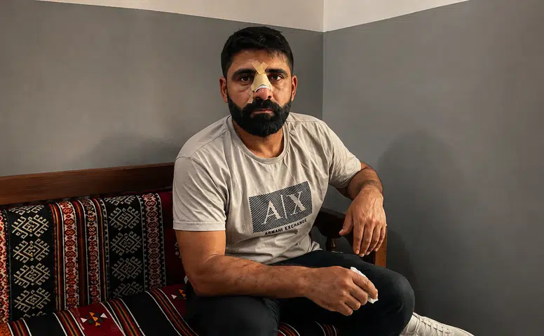 Bayburt’ta Amedspor forması giyen iki kişiye saldırı: Bir kişinin burnunda 5 kırık oluştu